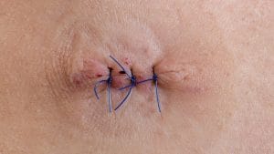 AdobeStock_131037157