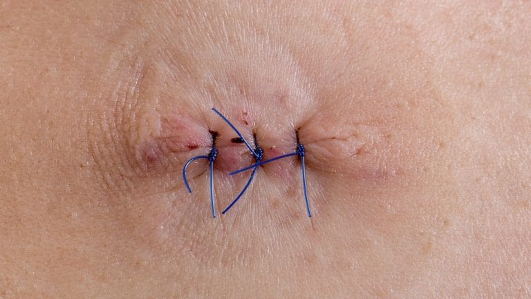 AdobeStock_131037157