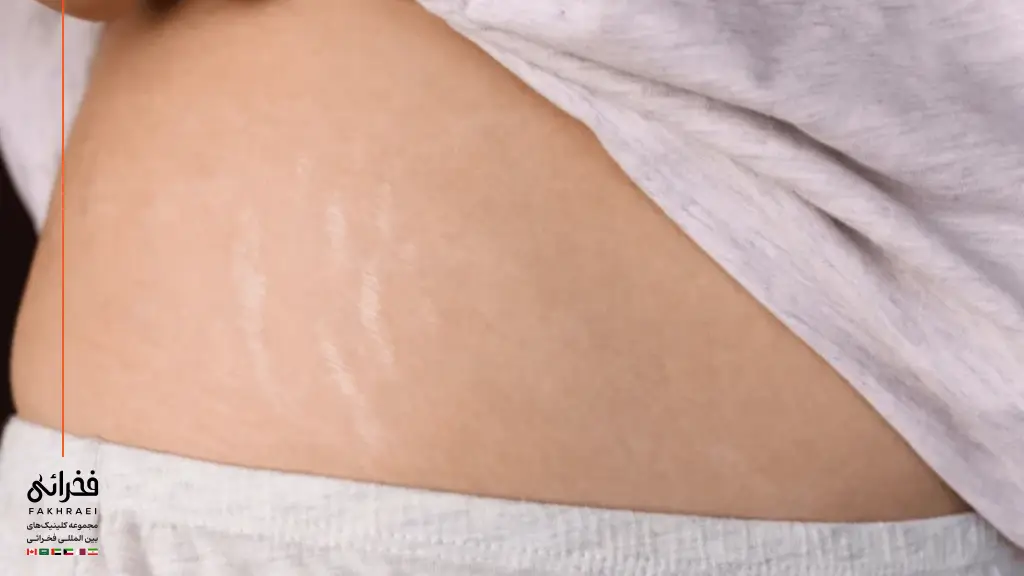 علت ترک پوستی