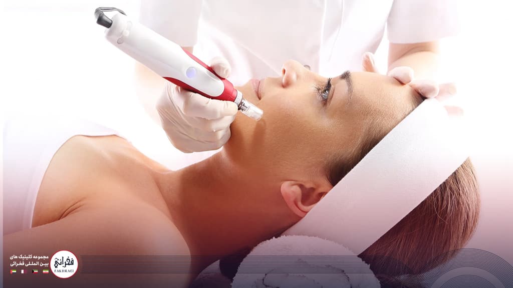 میکرونیدلینگ