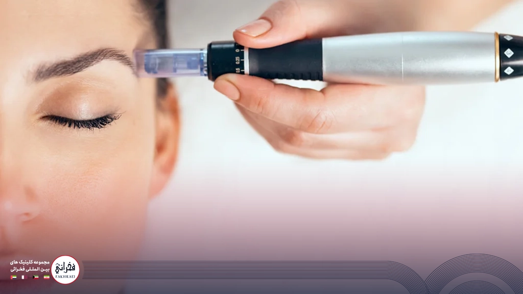 مزوتراپی ابرو روشی موثر برای تقویت ابروها