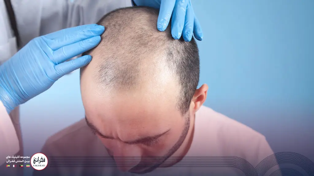 بررسی یک پزشک عدم ایجاد خطرات کاشت مو