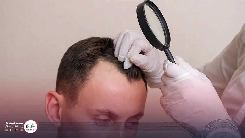 پزشک در حال بررسی آزمایش قبل از کاشت مو