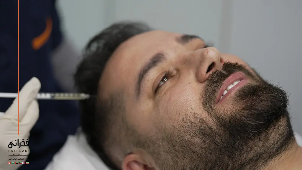 فواید مزوتراپی پس از کاشت مو