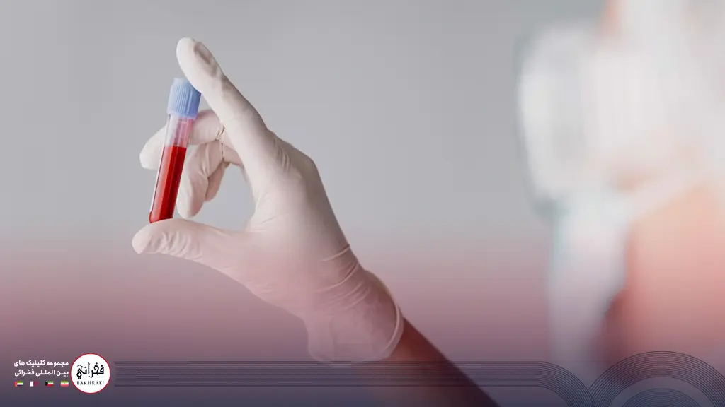 تست خون در آزمایش قبل از کاشت مو