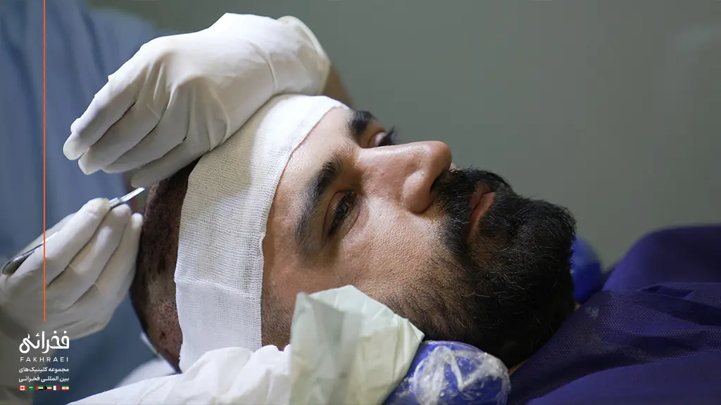 متخصص در حال کاشت مو برای یک فرد با موهای کم پشت