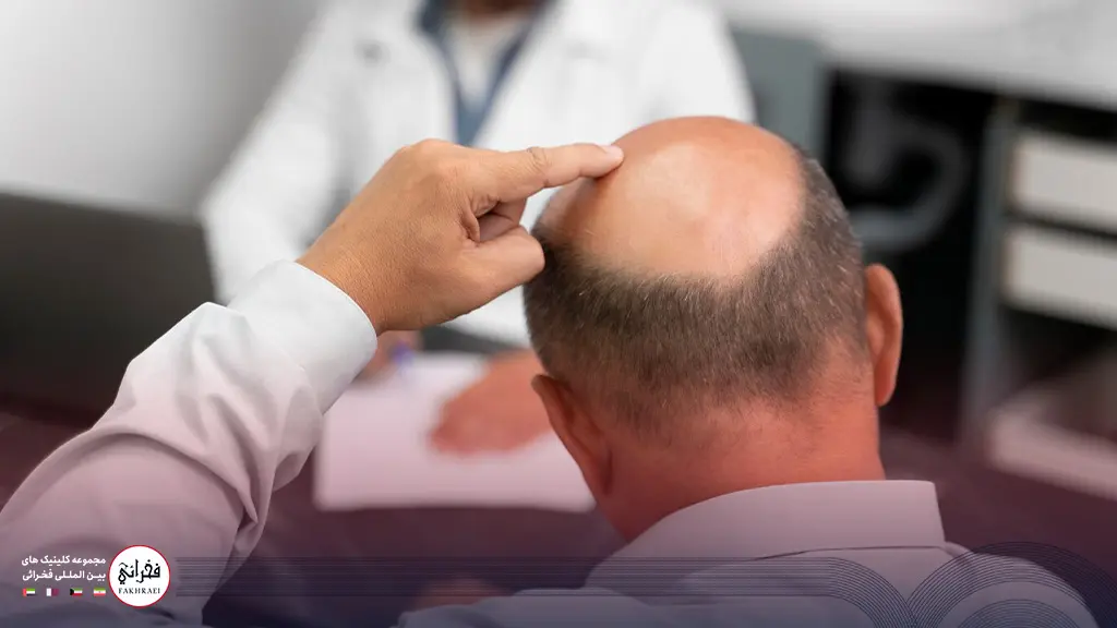 مشاوره با پزشک برای بررسی مناسب بودن کاشت مو