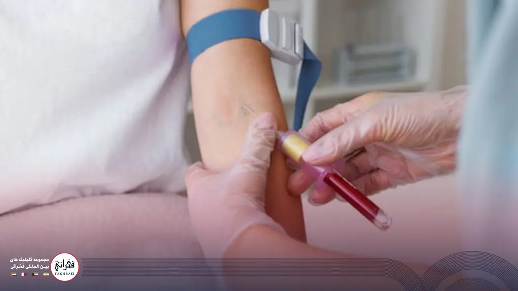 انجام چکاپ پس از دریافت هزینه آزمایش‌های کاشت مو