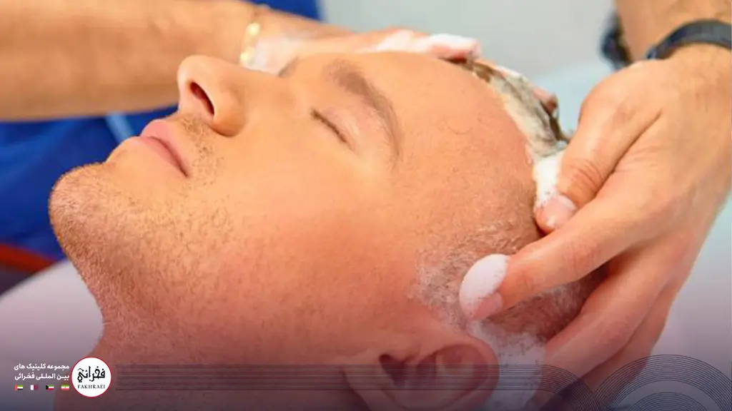 شستن سر مرد بعد از کاشت مو در زمان مناسب