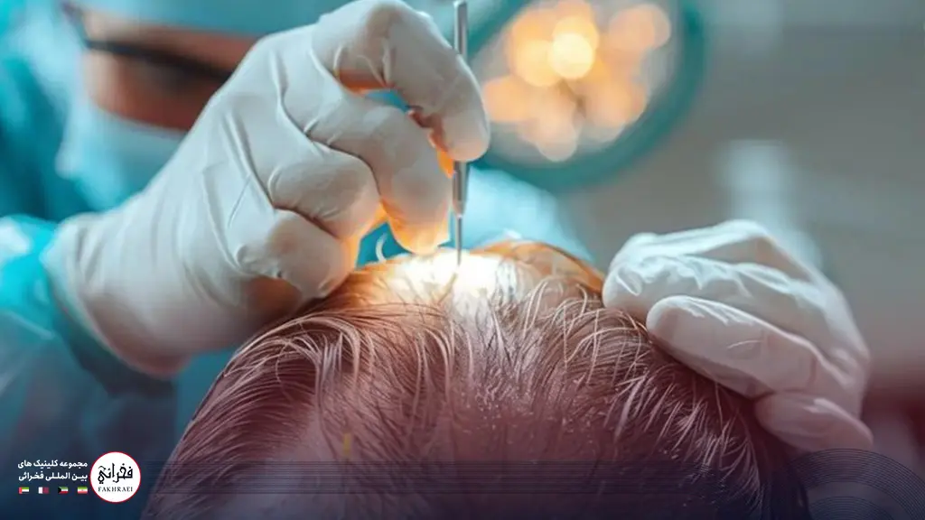 عوامل موثر بر شدت زخم‌های کاشت مو