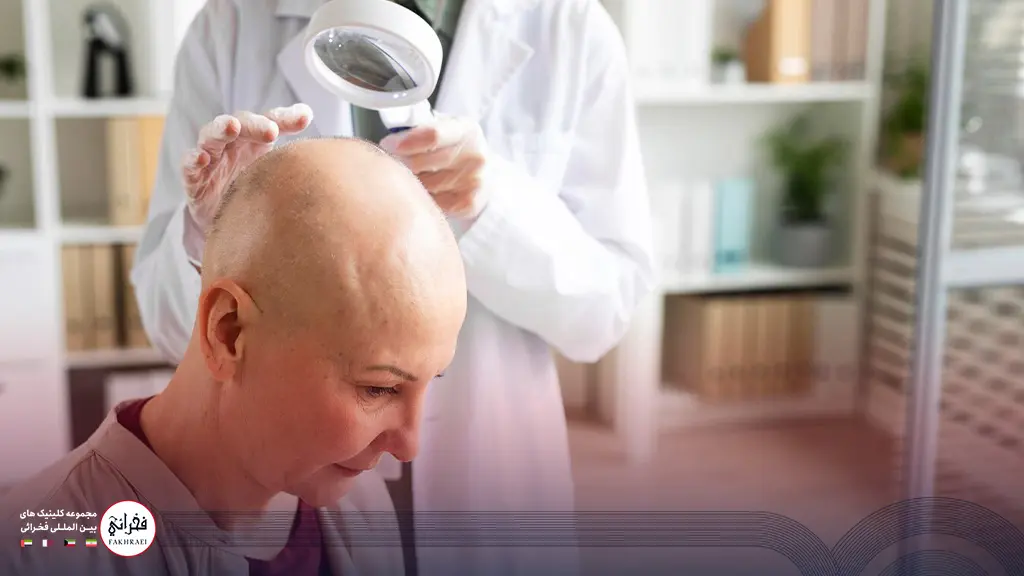 کاشت مو بدون بانک مو برای خانم ها