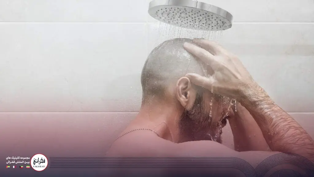 یک مرد در حال شستن سر پس از کاشت مو توسط خود