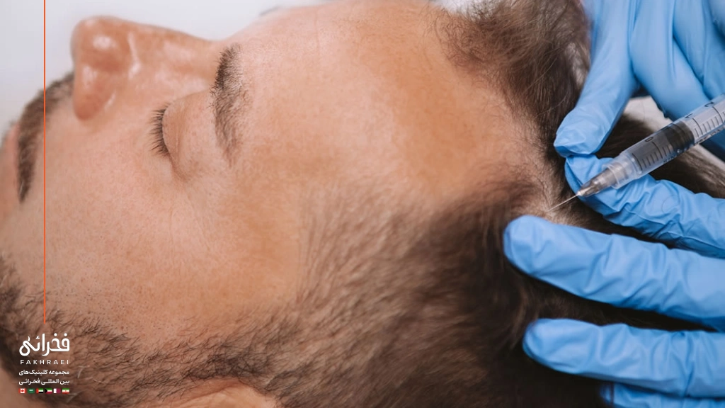 درمان کاشت موی ناموفق