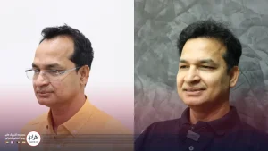 ایا کاشت مو دائمی است؟