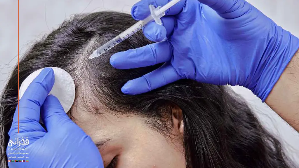 پزشک در حال درمان ریزش سکه ای مو