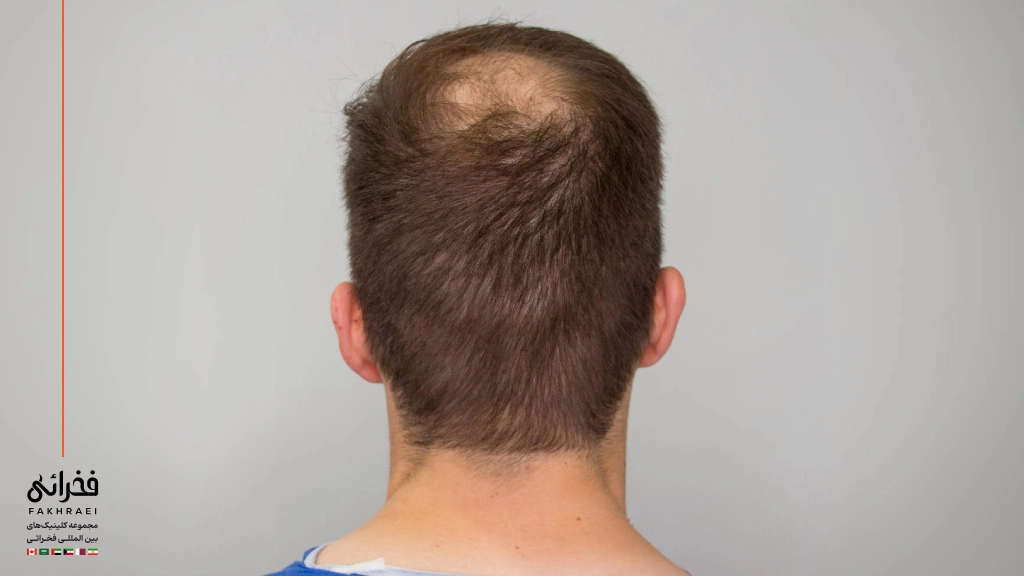 عکس بانک موی قوی