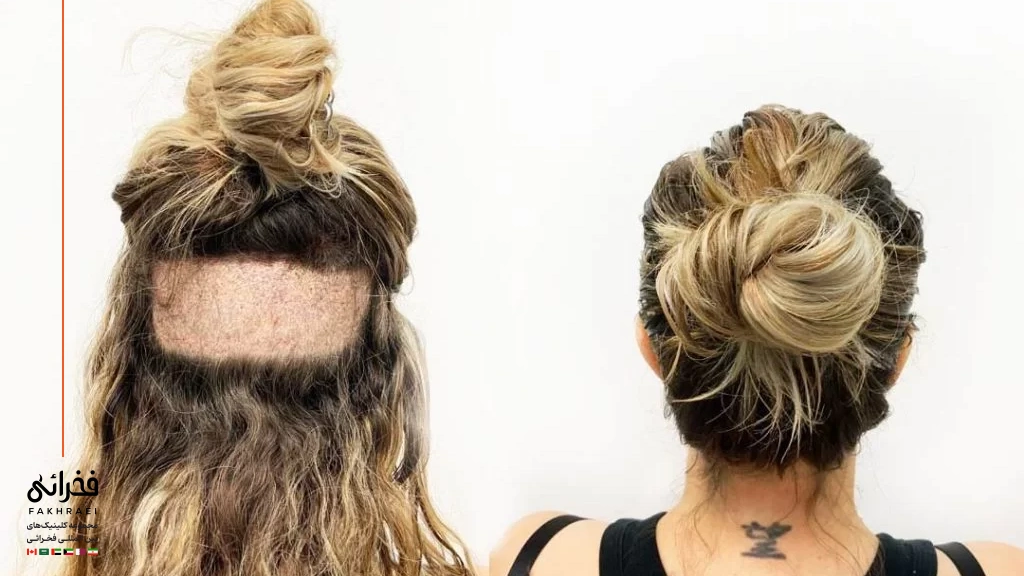 بانک موی زنان