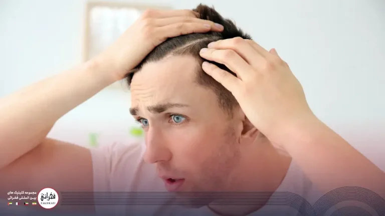 جلوگیری از ریزش مو