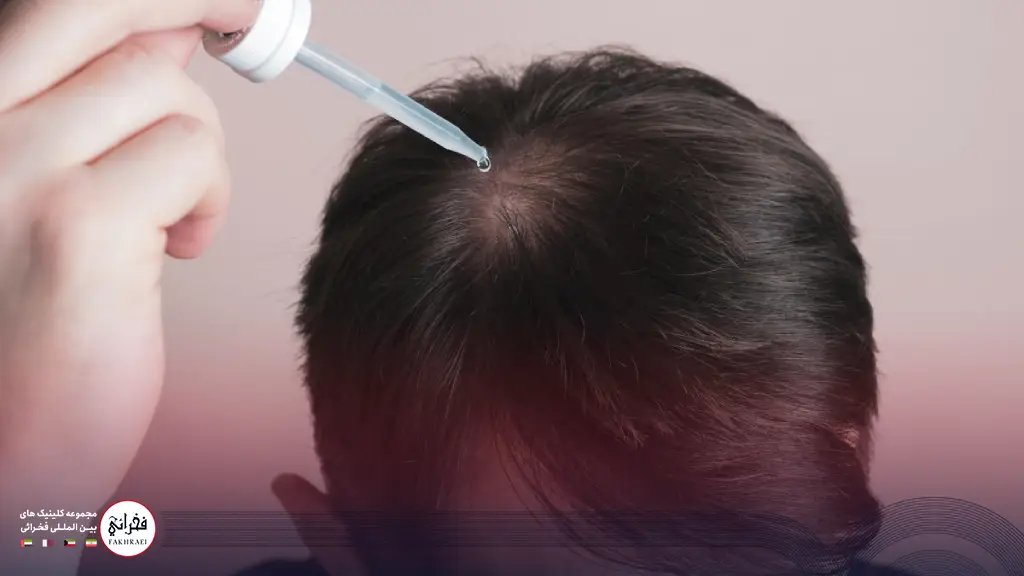 ماینوکسیدیل