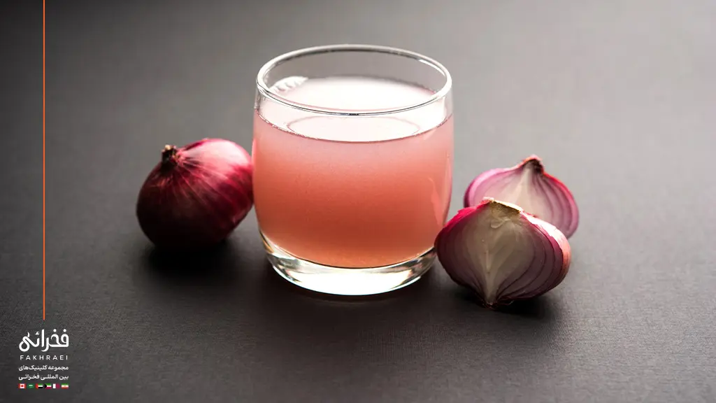 استفاده از آب پیاز برای درمان ریزش مو
