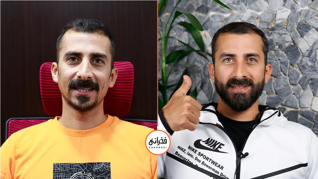 تفاوت قبل و بعد از کاشت ریش | هزینه کاشت ریش چقدر است؟