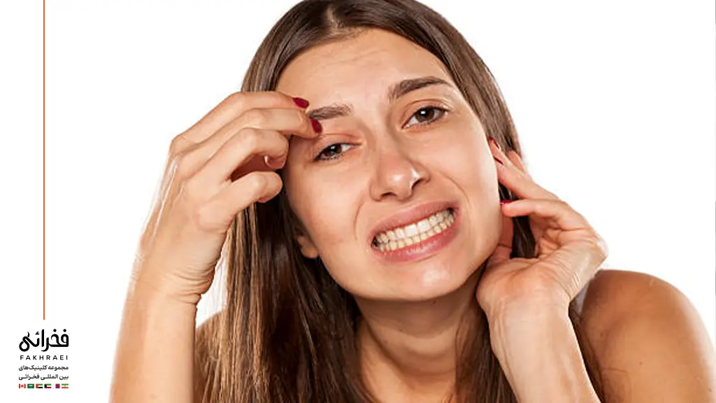 خارش پس از کاشت ابرو