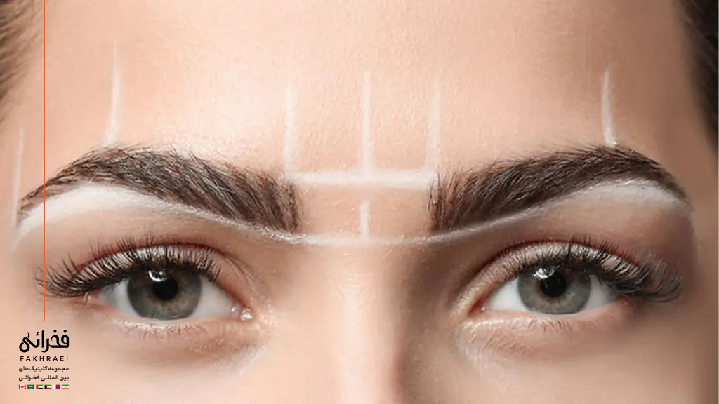 کاشت ابرو چگونه انجام می‌شود؟