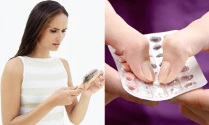 قرص برای ریزش موی هورمونی