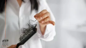 علت ریزش مو در زنان بالای ۴۰ سال