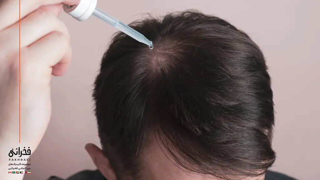 روغن‌های گیاهی برای ریزش مو سکه‌ای