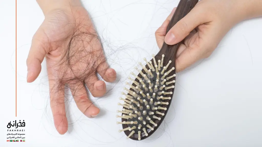 چرا زنان بالای ۴۰ سال دچار ریزش مو می‌شوند؟