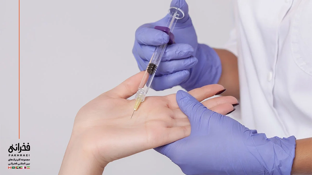 تزریق بوتاکس به کف دست