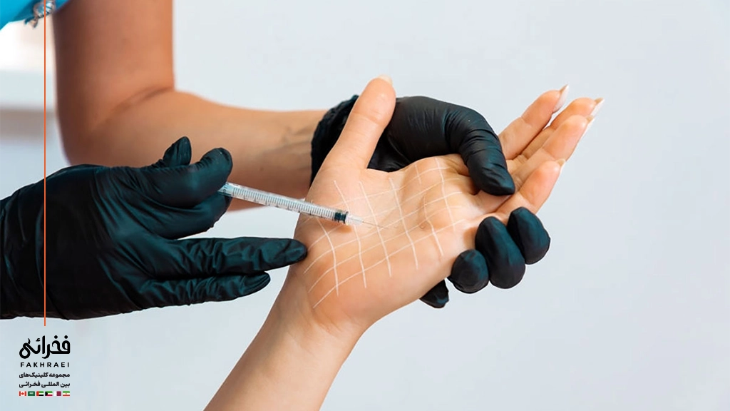 مراحل انجام بوتاکس کف دست