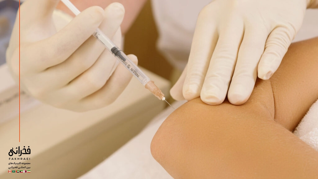 فیلر بادی برای آرنج