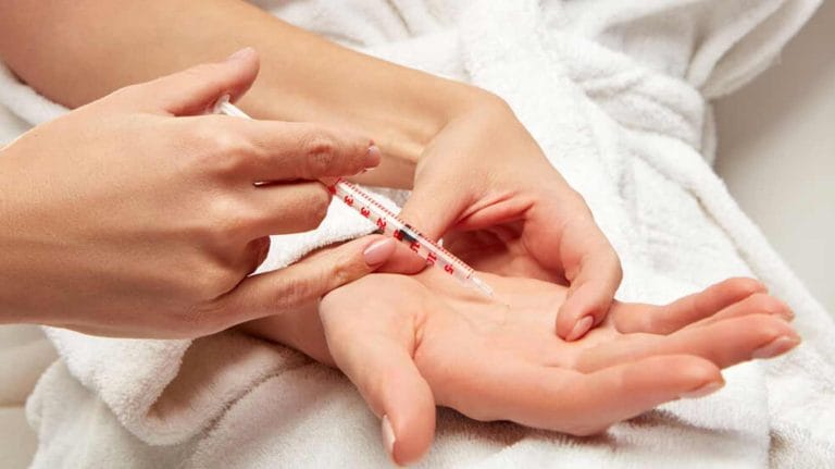 بوتاکس کف دست