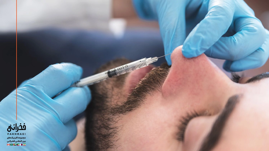 فیلر بینی-تزریق فیلر بینی به بینی