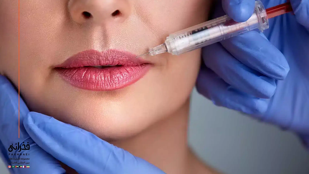 تزریق ژل لب نورامیس