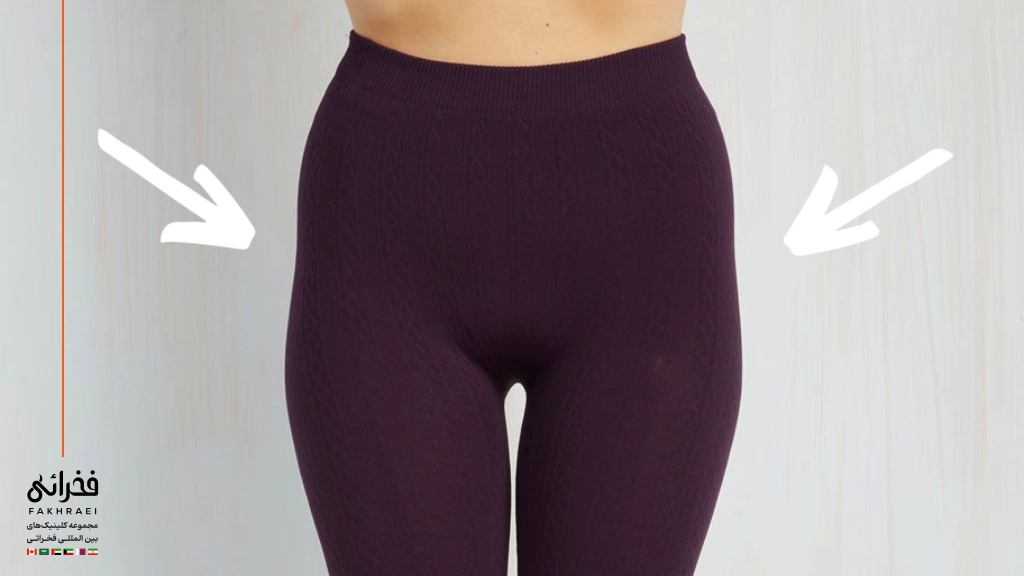 ناجیه هیپ دیپ