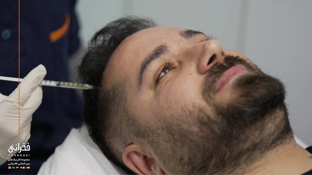 پی آر پی مو برای چه کسانی مناسب است