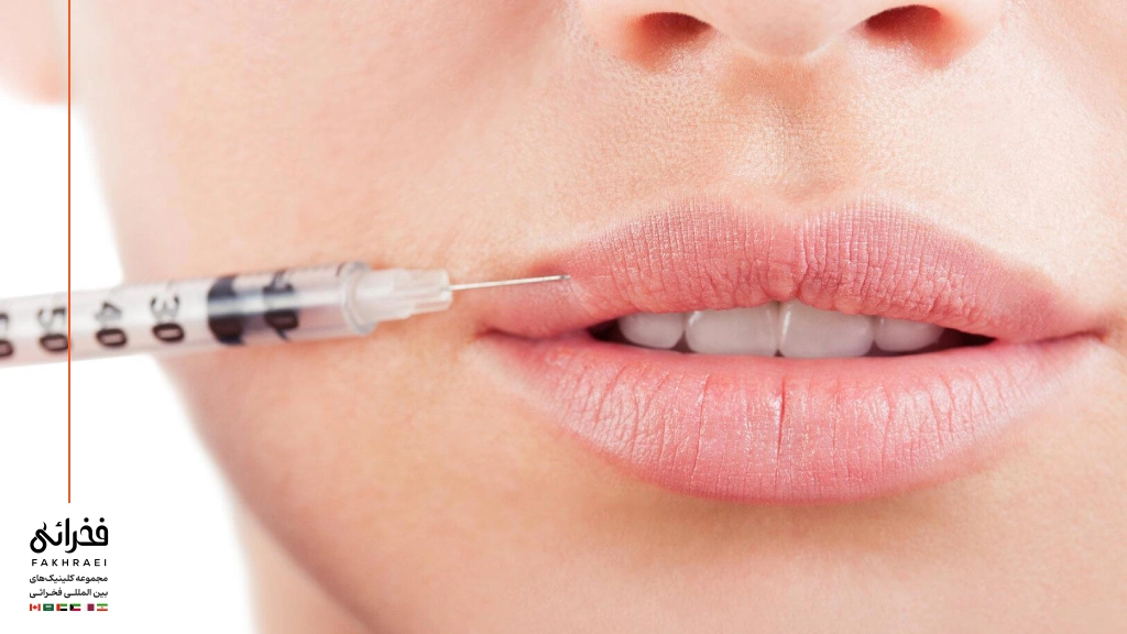 تزریق فیلر لب