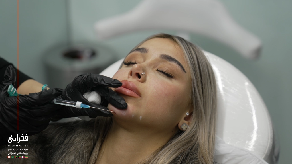 نحوه تزریق فیلر