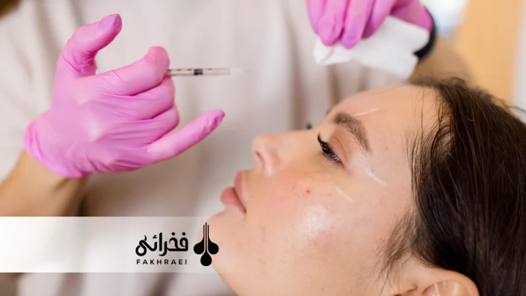 مزوتراپی ابرو بعد از کاشت