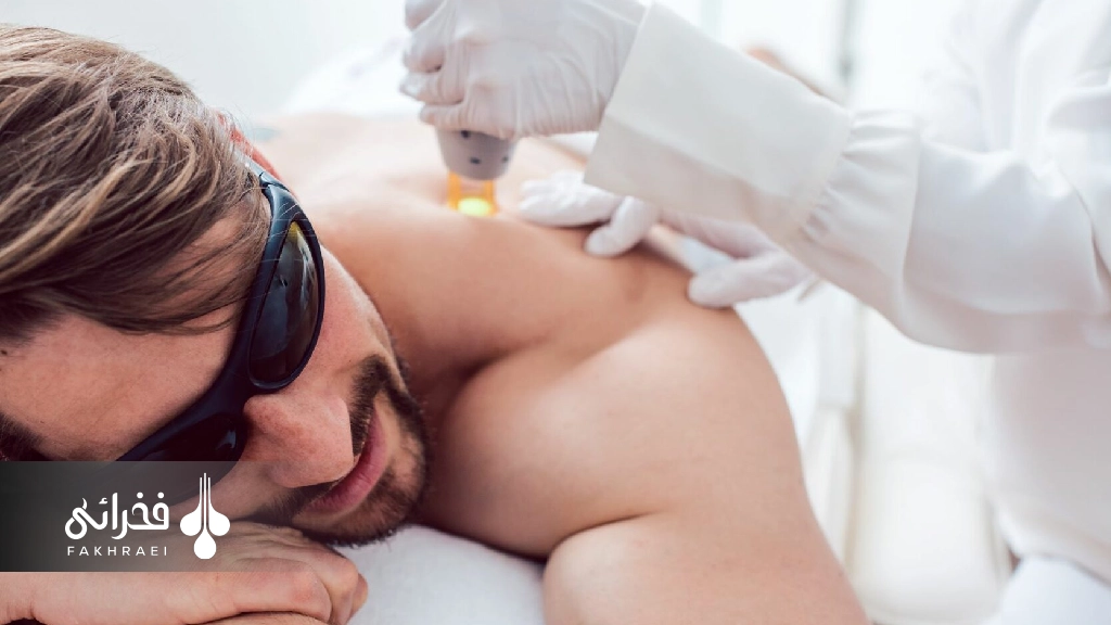 مدت زمان انجام لیزر فول بادی