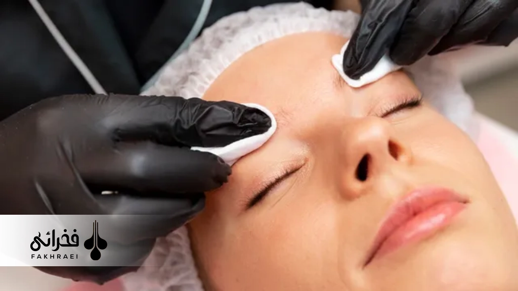 دوره نقاهت کاشت ابرو