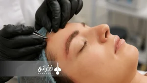 مراقبت‌های بعد از کاشت ابرو