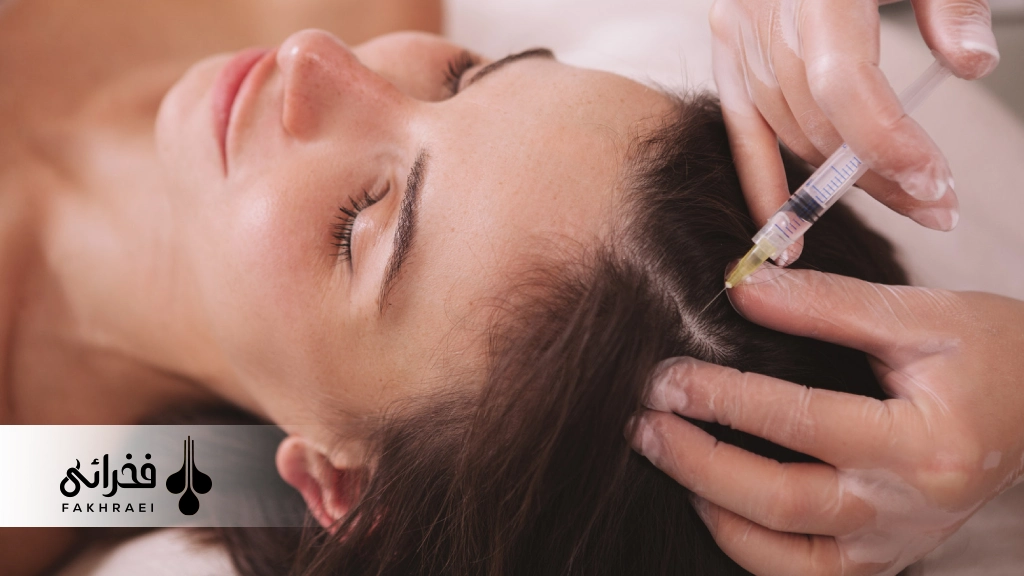 درمان ریزش مو با پی آر پی و مزوتراپی
