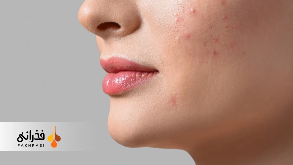 آیا از بین بردن لک صورت با خمیردندان امکانپذیر است؟