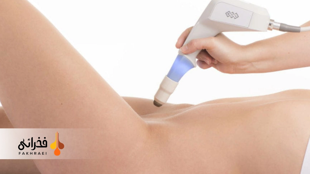 تاثیر لیزر در رفع تیرگی واژن