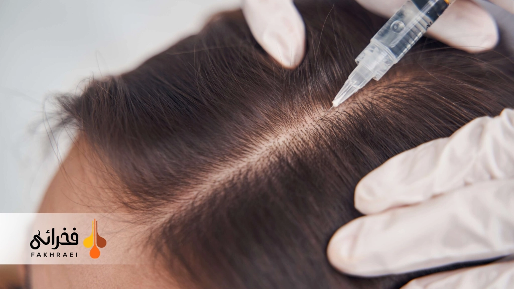 عوارض شایع مزوتراپی موی سر