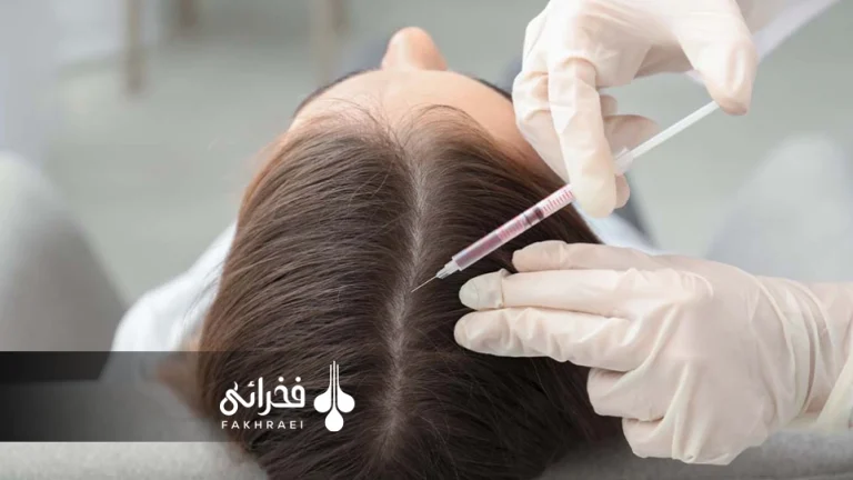 عوارض مزوتراپی مو